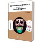 microimplantes