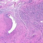 Figura-8