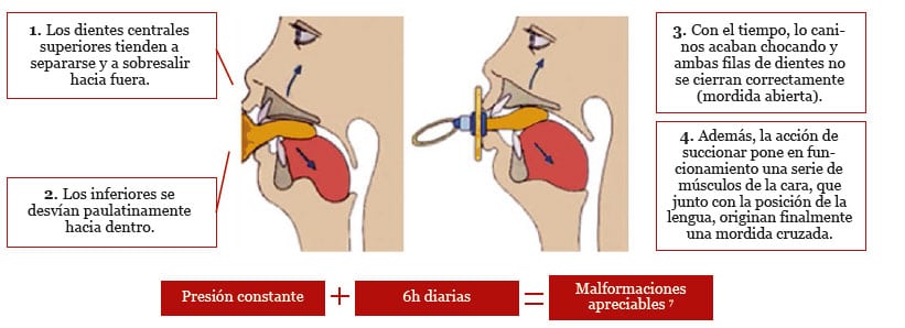 maloclusion-discusion