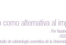 El puente reforzado como alternativa al implante