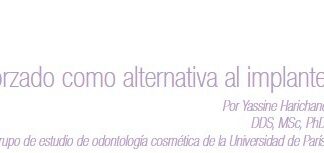 El puente reforzado como alternativa al implante